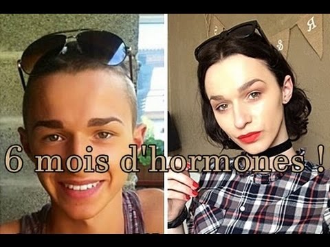 Les traitements hormonaux féminisants - Vivre Trans